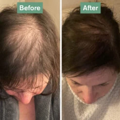 Coola Store 17 Coola Store -Coola Store hair saviour before after square 5f76b7ed 630b 4d9b 81e6 cf4ba926a834