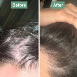 Hair Saviour® 22 Hair Saviour® -Coola Store hairsaviourbefore aftersquareruby