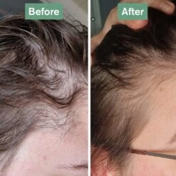 Hair Saviour® 23 Hair Saviour® -Coola Store rebeccahairsaviourbefore aftersquare