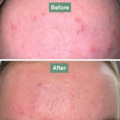 Skin Saviour® -Coola Store skinsaviourbefore after 19d5deb5 d034 4fb6 8d48 0d16378dcf5c